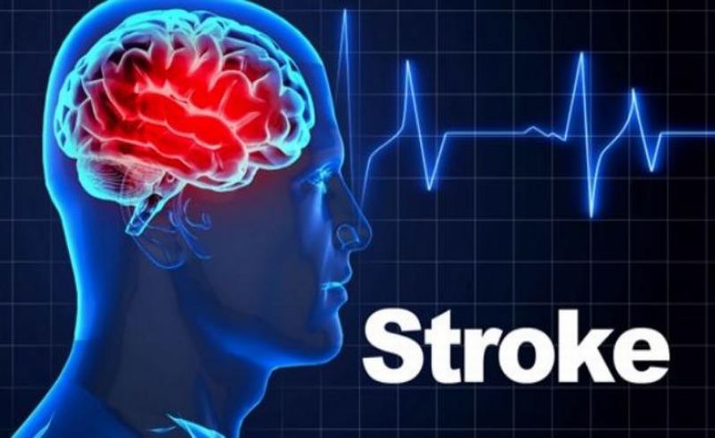 Musim Kemarau Datang, Hati-hati Stroke Mudah Menyerang saat Cuaca Panas