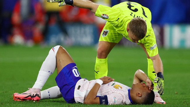 Prancis Hajar Austria 1-0: Hidung Mbappe Berdarah-darah